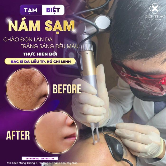 Không gian thư giãn cao cấp tại DIỆP THẢO MEDI-SPA