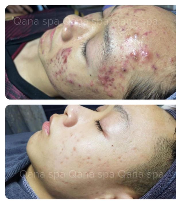 Không gian trị liệu chuyên nghiệp tại QANA Beauty Spa