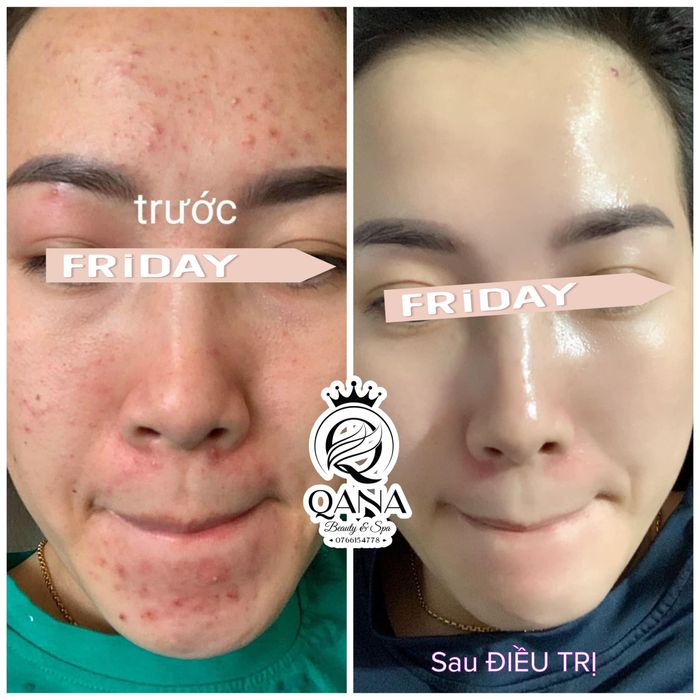 Khoảnh khắc thư giãn tại QANA Beauty Spa