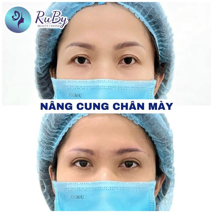 Hình ảnh không gian sang trọng tại Viện Thẩm Mỹ RuBy Beauty Center