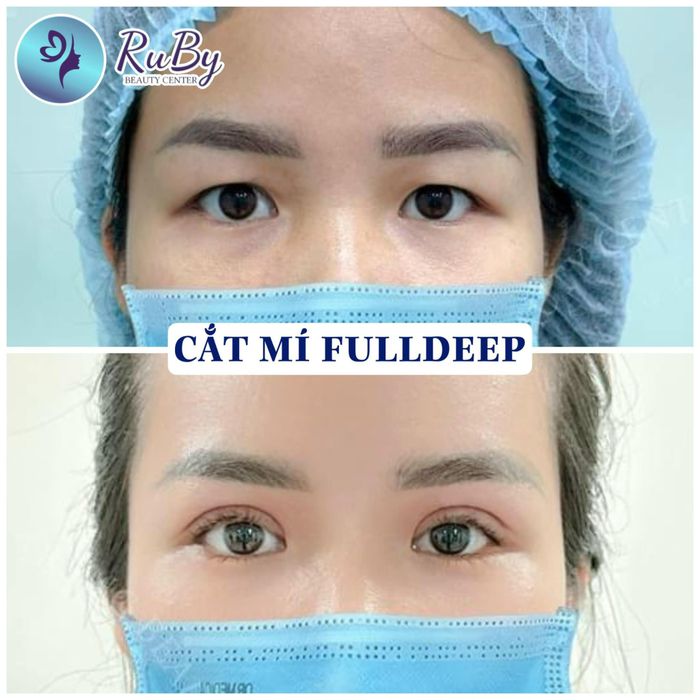 Hình ảnh thực tế về không gian sang trọng tại RuBy Beauty Center
