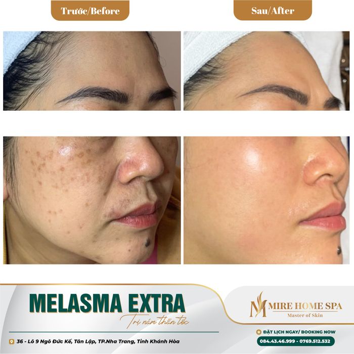 Không gian sang trọng đạt chuẩn tại MiRe Home Spa - Ảnh 1