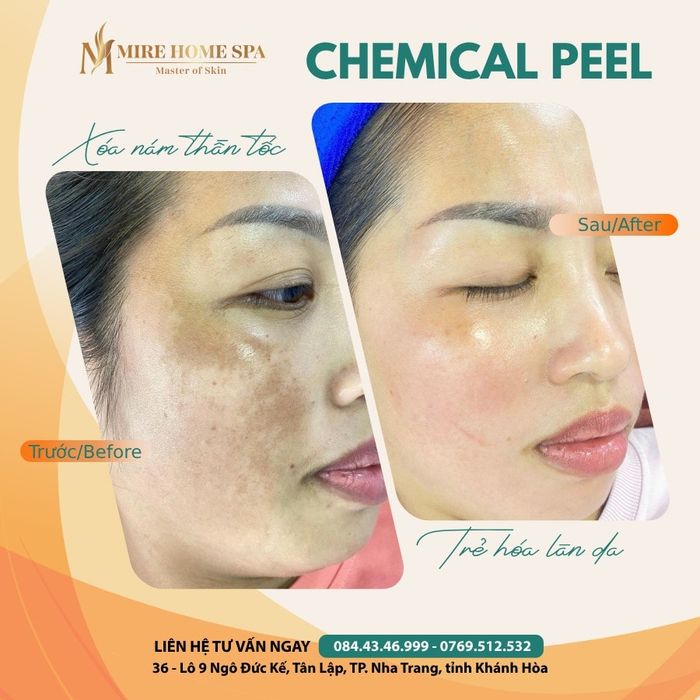 Quy trình chăm sóc da chuyên nghiệp tại MiRe Home Spa - Ảnh 2