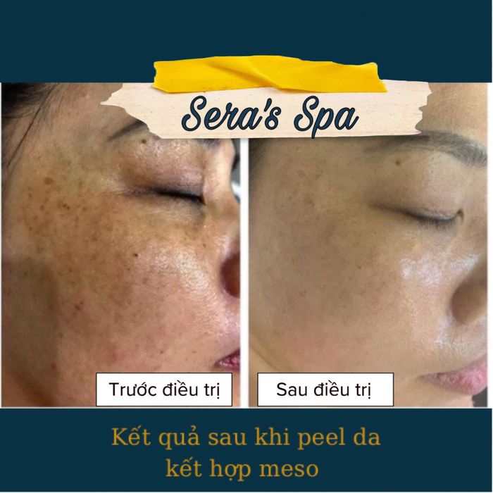 Hình ảnh không gian sang trọng tại Sera’s Spa & Clinic