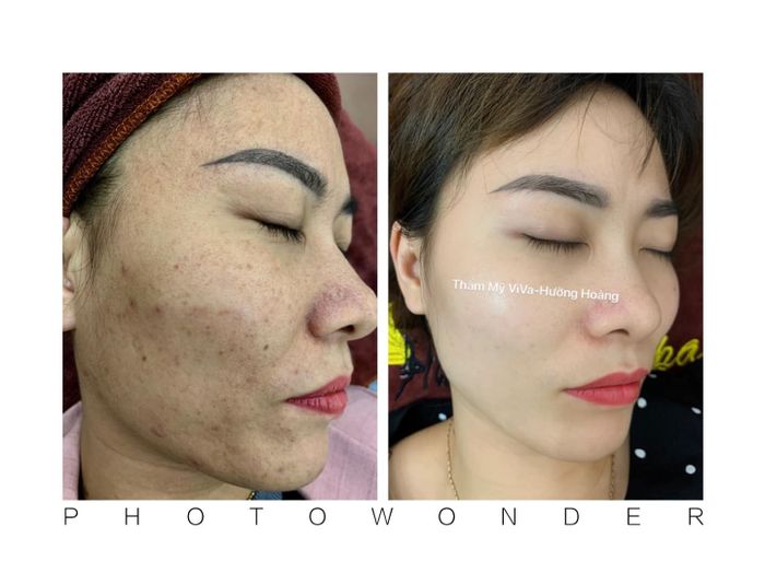 Không gian hiện đại và quy trình trị liệu chuẩn y khoa tại Spa Hường Hoàng