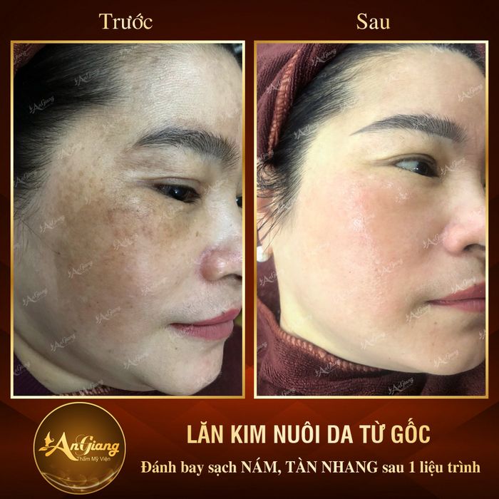 Không gian sang trọng và quy trình trị liệu chuyên nghiệp tại An Giang Beauty & Spa