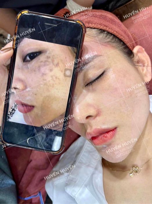 Không gian sang trọng và quy trình trị liệu chuẩn quốc tế tại Huyền Lady Spa