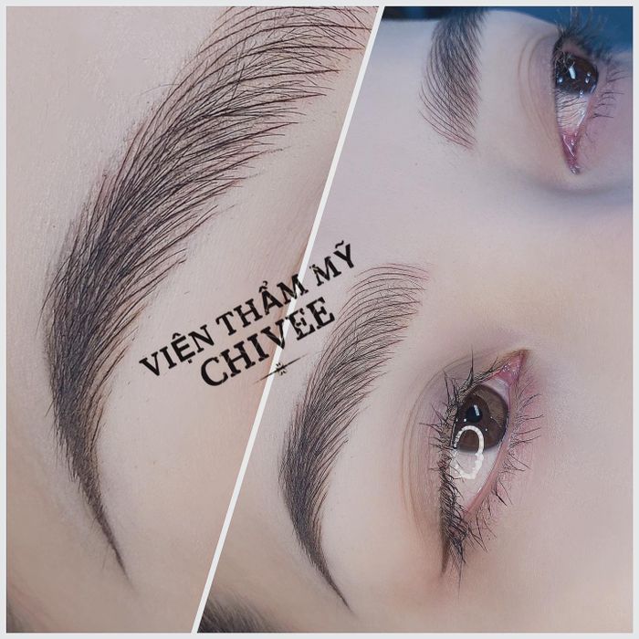 Viện Thẩm Mỹ ChiVee - Trải nghiệm dịch vụ cao cấp (Ảnh 2)