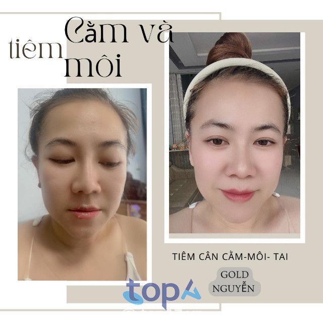 Spa làm đẹp tốt nhất tại TP Tuy Hòa