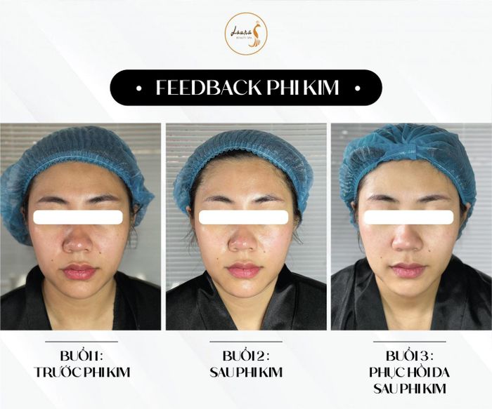 Hình ảnh Laura Spa
