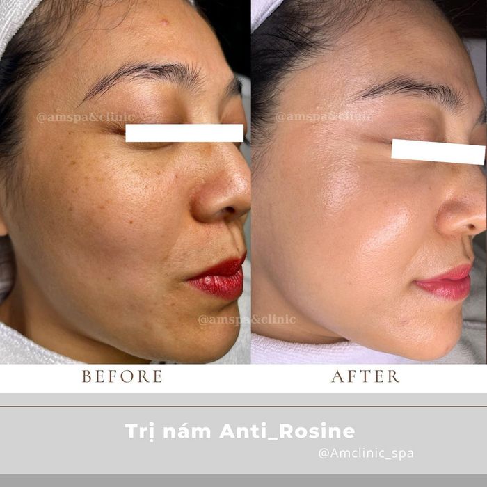 Hình ảnh 1 của Ẩm Spa & Clinic