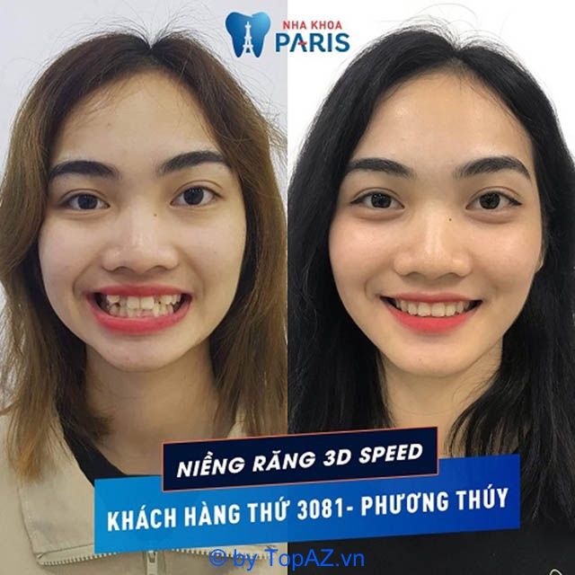 Điểm đến vàng cho dịch vụ niềng răng chất lượng tại thành phố Vinh