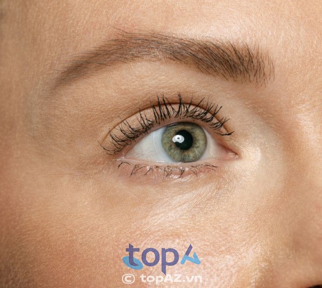Phòng khám Da liễu Medcare tại TPHCM là lựa chọn uy tín trong việc điều trị thâm quầng mắt và các bệnh lý về da.