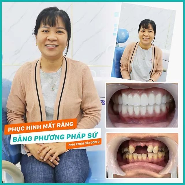 Nha Khoa Sài Gòn 9 - Địa chỉ nha khoa uy tín tại Gia Nghĩa, Đắk Nông, nơi mang đến những dịch vụ chăm sóc răng miệng chất lượng cao.