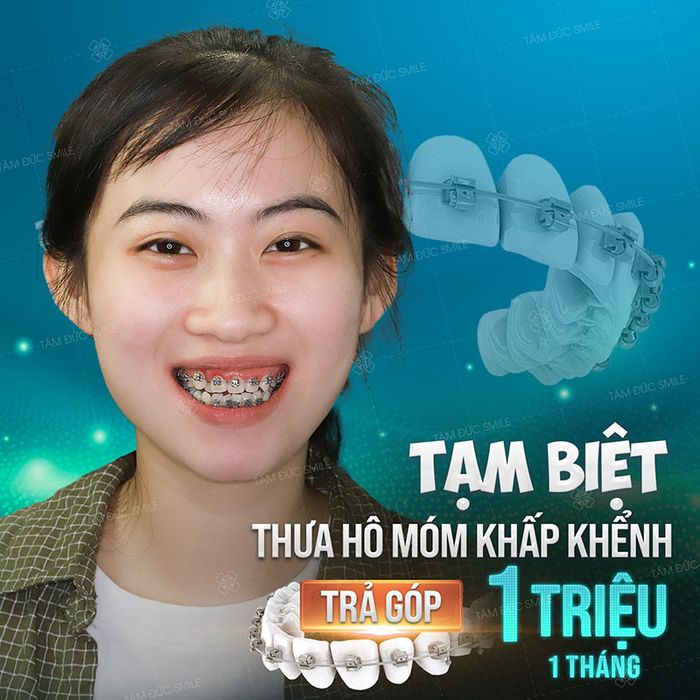 Không gian hiện đại chuẩn quốc tế tại Nha Khoa Tâm Đức Smile Biên Hòa