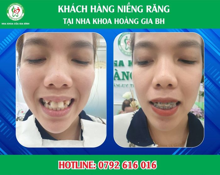 Không gian sang trọng tại Nha Khoa Hoàng Gia