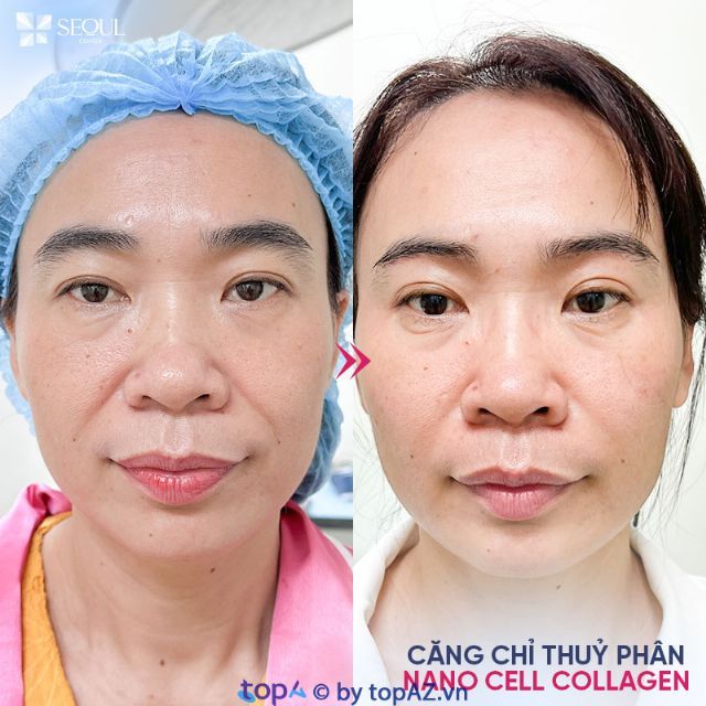 Địa chỉ khám và điều trị da liễu uy tín được khách hàng tin chọn tại Biên Hòa