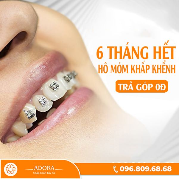 Không gian điều trị cao cấp tại Nha Khoa Adora Sài Gòn
