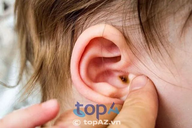 Chuyên gia hàng đầu về điều trị bệnh lý Tai Mũi Họng