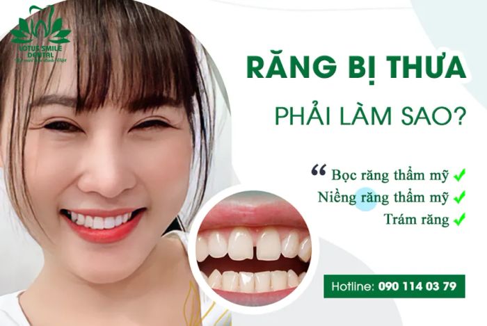 Lotus Smile Dental ảnh 2