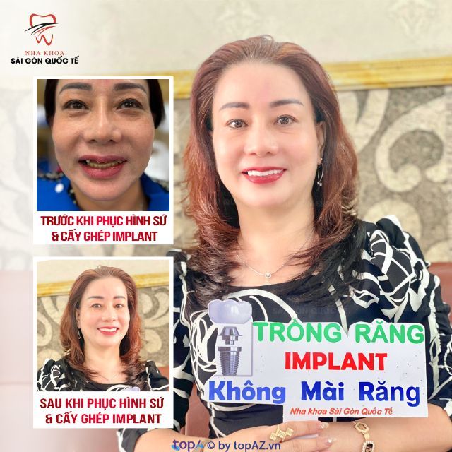 Địa chỉ nha khoa uy tín tại TP. Rạch Giá, Kiên Giang – lựa chọn tin cậy cho sức khỏe răng miệng