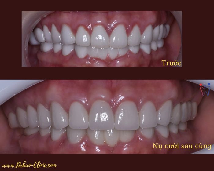 NHA KHOA DR.BÃO hình ảnh 3