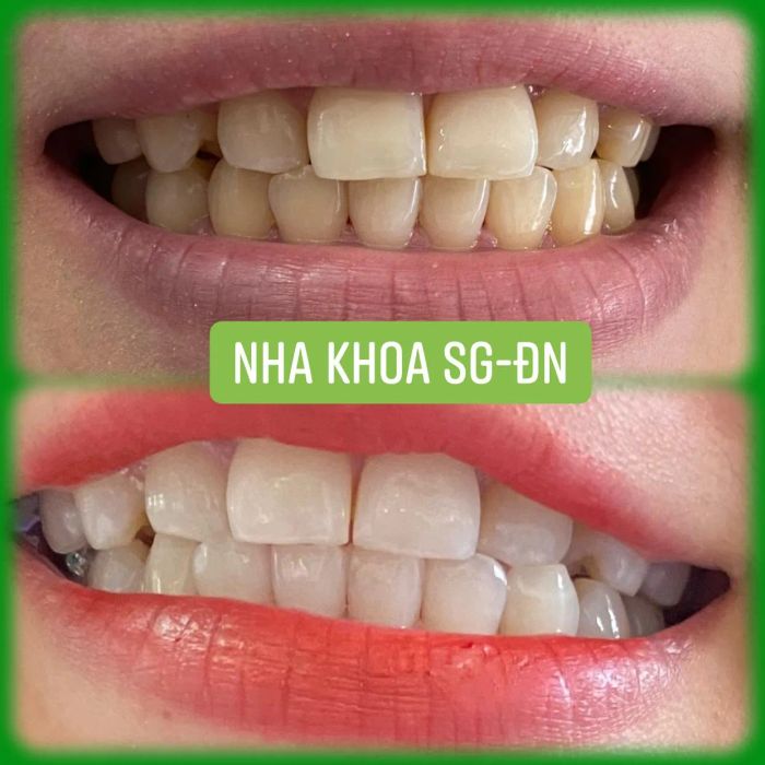 Nha Khoa Sài Gòn hình ảnh 3