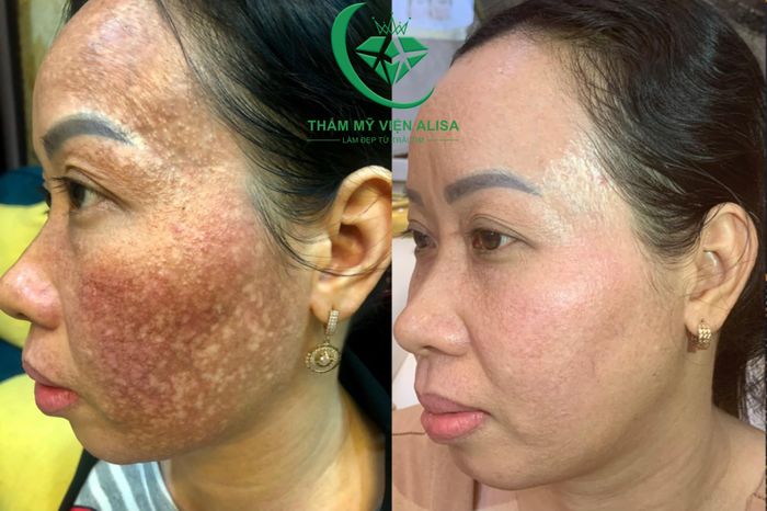 Không gian sang trọng tại Alisa Spa Cần Thơ