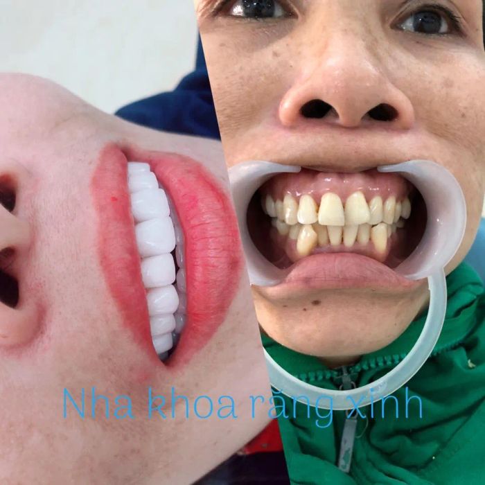 Nha Khoa Răng Xinh hình ảnh 2