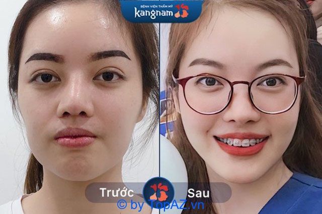 địa chỉ cấy mỡ trẻ hóa da tphcm