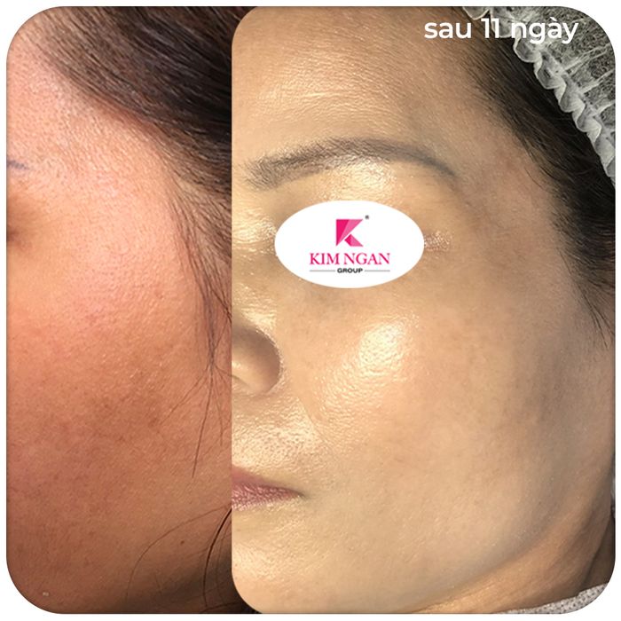 Hình ảnh KIM NGAN Beauty Care 2