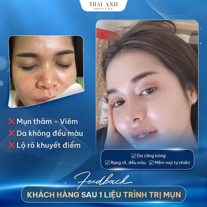 Không gian sang trọng và hiện đại tại Thai Anh Beauty & Spa