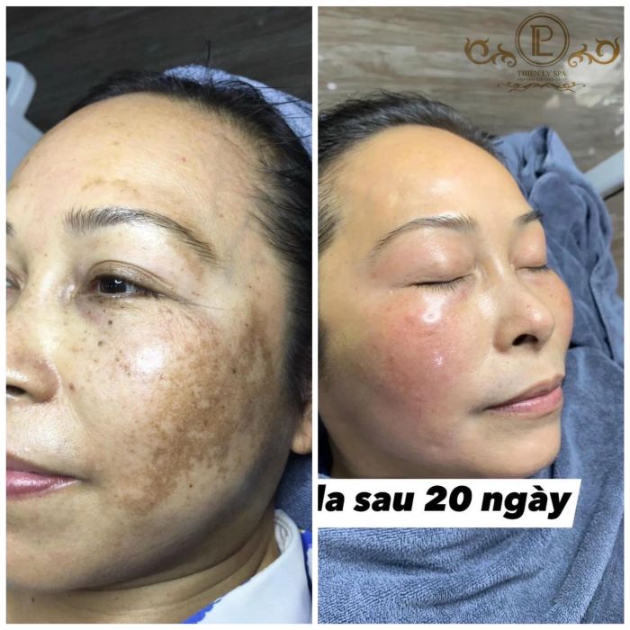 Thiên Lý Spa - Hình ảnh 1