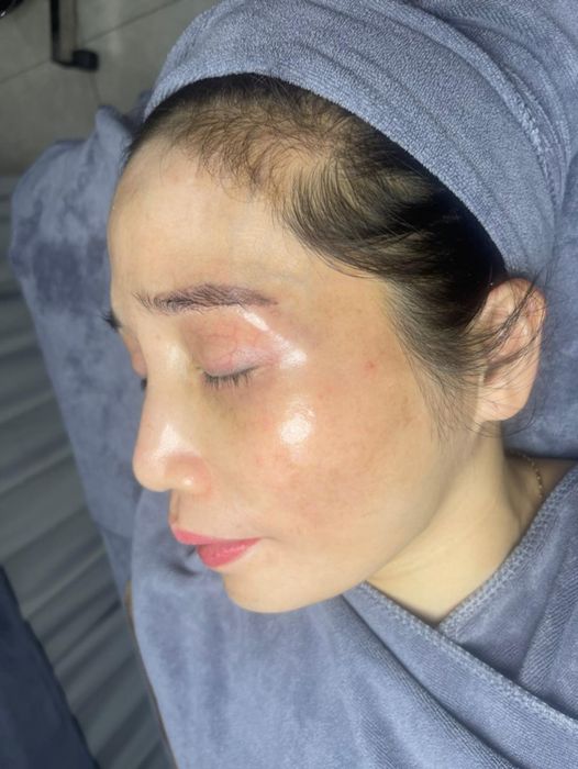 Hình ảnh quy trình chăm sóc da chuyên nghiệp tại MEI Kore Beauty