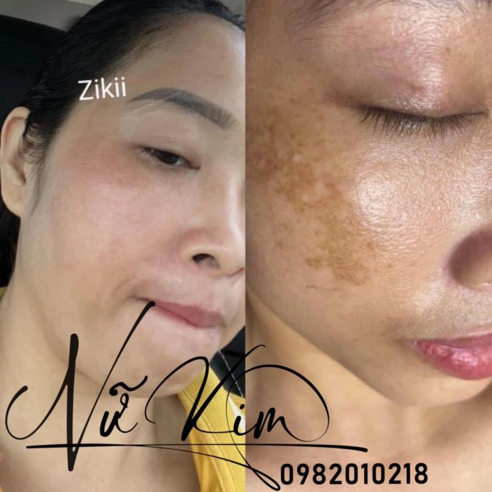 Ảnh 2 - THIÊN LÝ BEAUTY & SPA