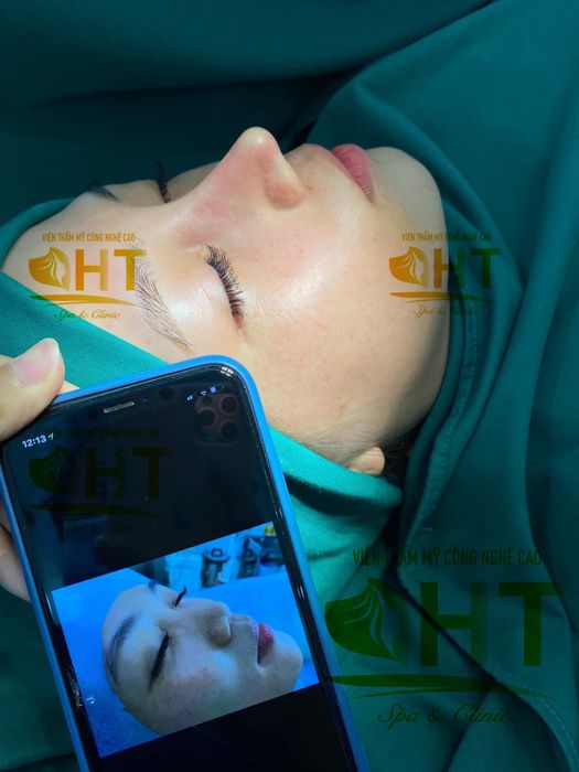 Viện Thẩm Mỹ HT - Hình ảnh 1