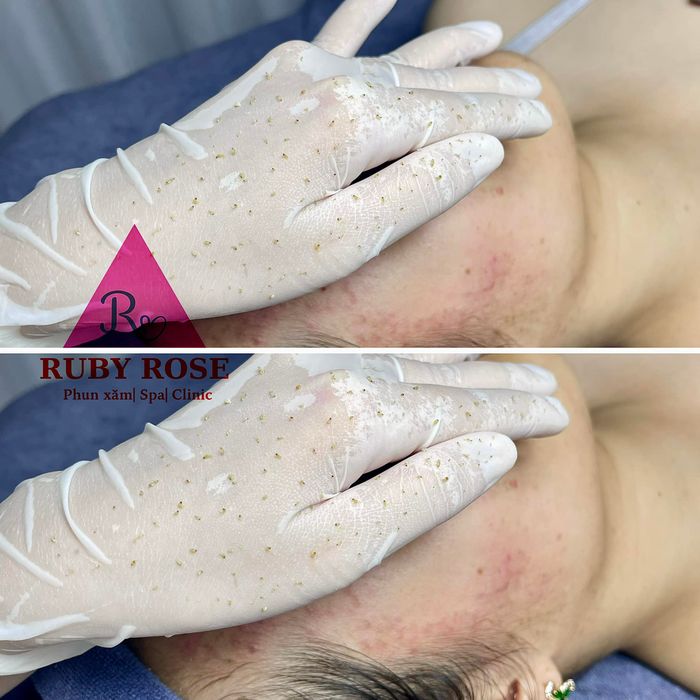 Hình ảnh Ruby Rose Spa 1