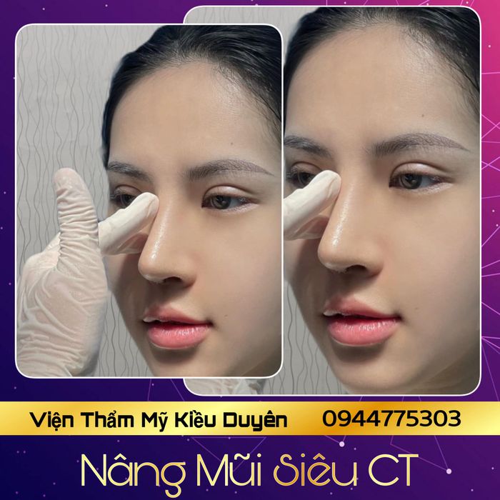Thẩm Mỹ Kiều Duyên - Hình ảnh 1