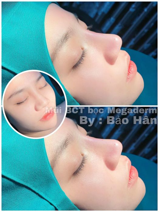 Bảo Hân Beauty Center - Hình ảnh 2
