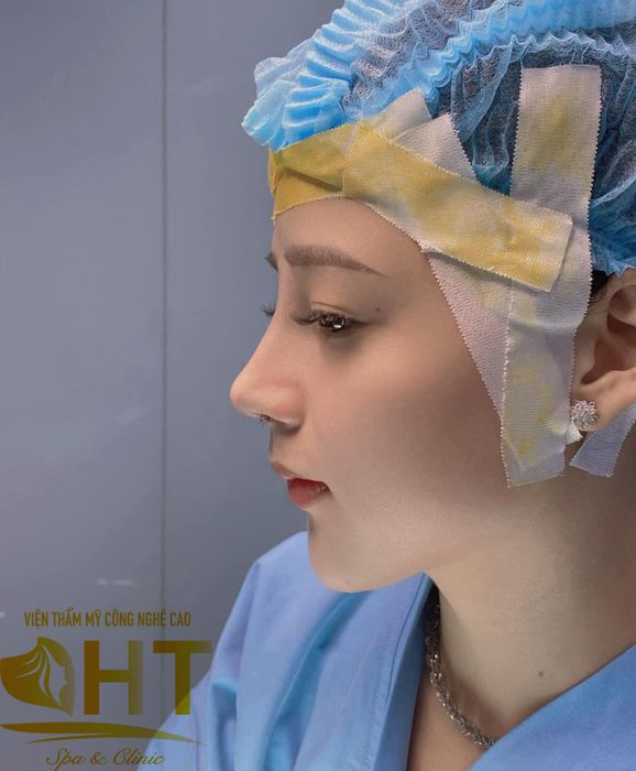 Viện Thẩm Mỹ HT - Hình ảnh 2