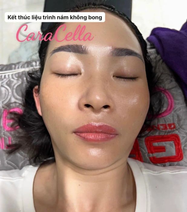 Ảnh 2 - Kim Ngân Spa