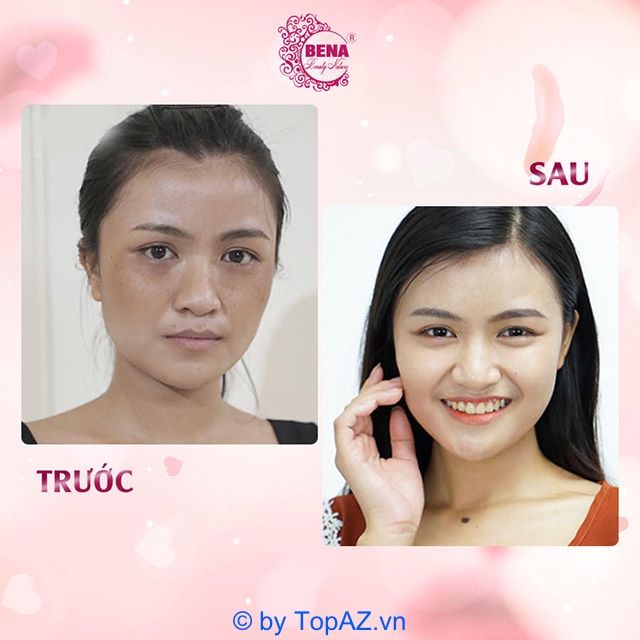 Thẩm mỹ viện tại TP. Buôn Ma Thuột, Đắk Lắk uy tín