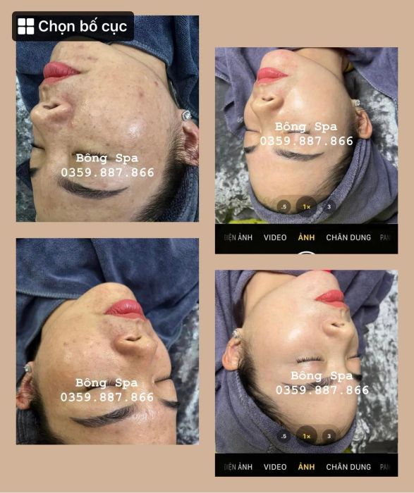 Bông Spa - Hình ảnh 2