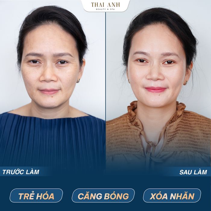 Hình ảnh quy trình chăm sóc da chuyên nghiệp tại Thai Anh Beauty & Spa