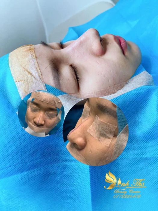 Anh Thơ Beauty Center - Hình ảnh 1
