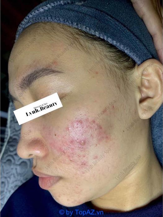 Hệ thống thẩm mỹ viện và spa cao cấp tại Long Thành