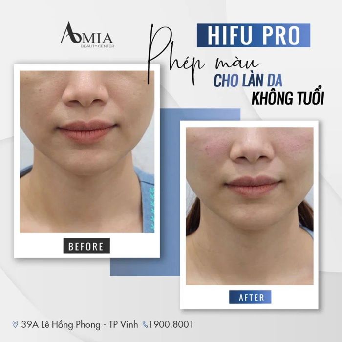 Amia Beauty Center ảnh 2 - góc nhìn ấn tượng về quy trình chăm sóc da chuyên sâu, nơi mỗi thao tác đều được thực hiện với độ chính xác tuyệt đối và sự nâng niu tối đa.