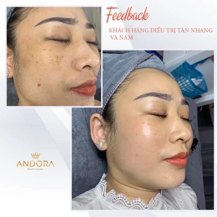 Andora beauty & clinic ảnh 1 - không gian sang trọng với phòng trị liệu tiêu chuẩn vàng, nơi mỗi bước chăm sóc da đều được thực hiện tỉ mỉ dưới bàn tay chuyên gia.