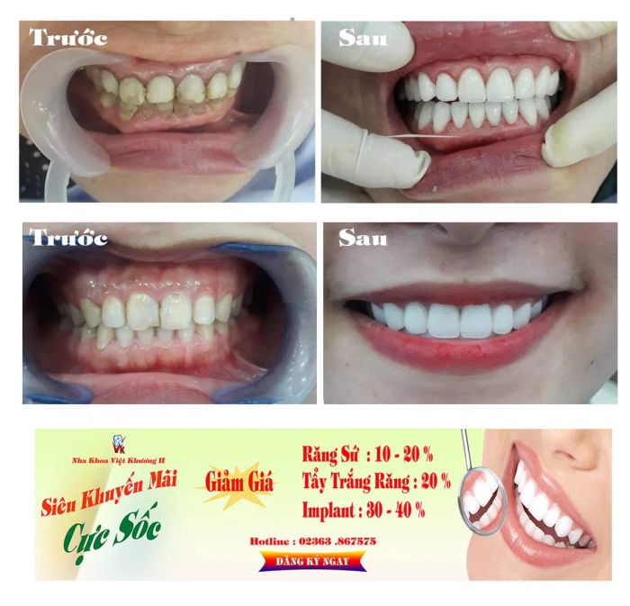 Nha khoa Việt Khương hình ảnh 1