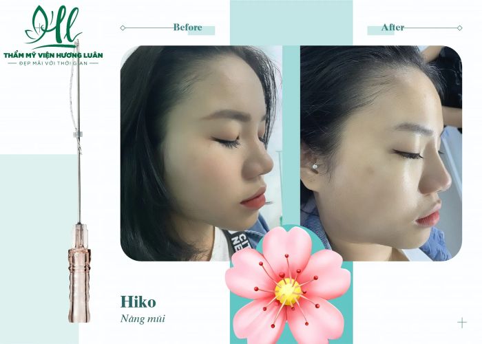 Hình ảnh Thẩm Mỹ Viện Hương Luân - Không gian sang trọng, dịch vụ đẳng cấp